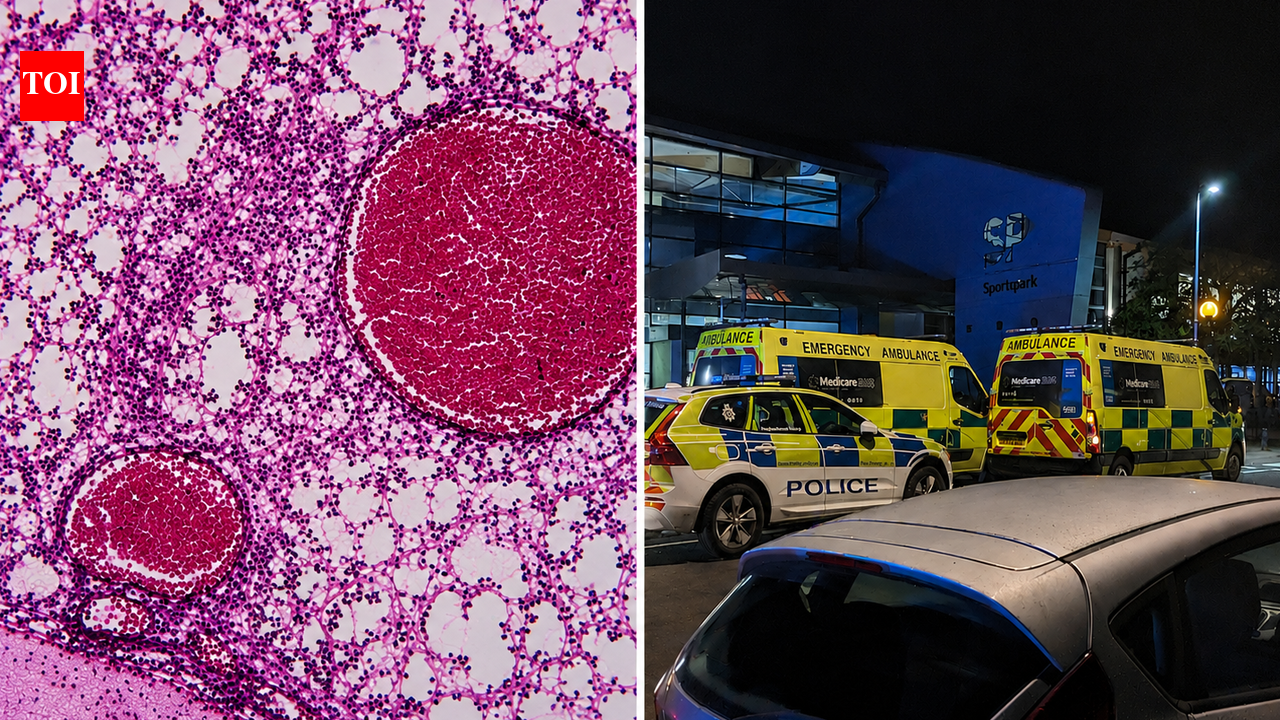 Meningitis outbreak sparks alarm after student dies and 2 others