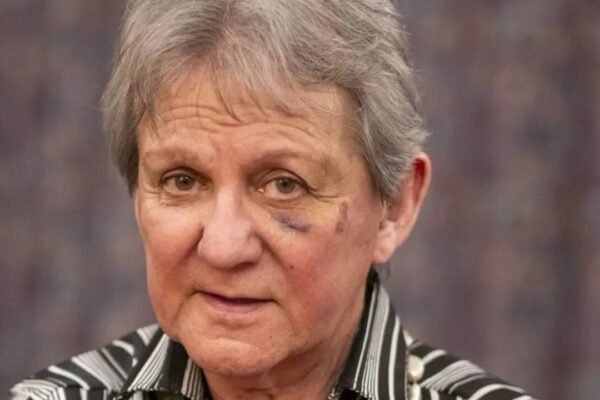 ‘Hard to recover from trauma TV antiques expert decides to