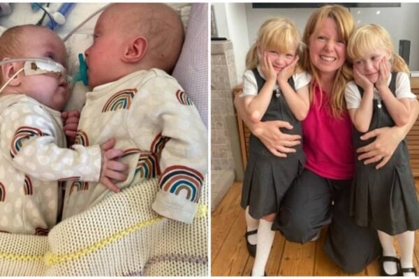 Mother of twin girls given less than 10 chance of