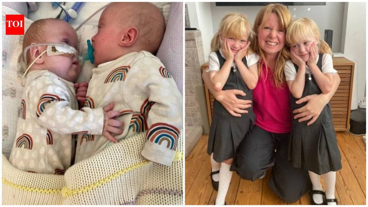Mother of twin girls given less than 10 chance of